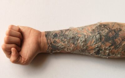 Tattoo korsten: hoeveel is normaal?