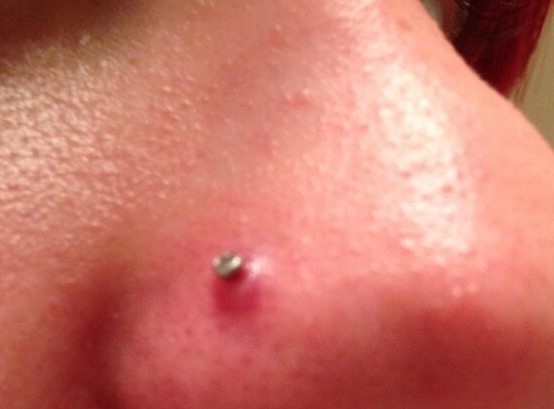 piercing infectie