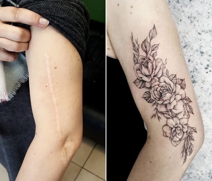 Kun je een tatoeage laten zetten over een litteken?