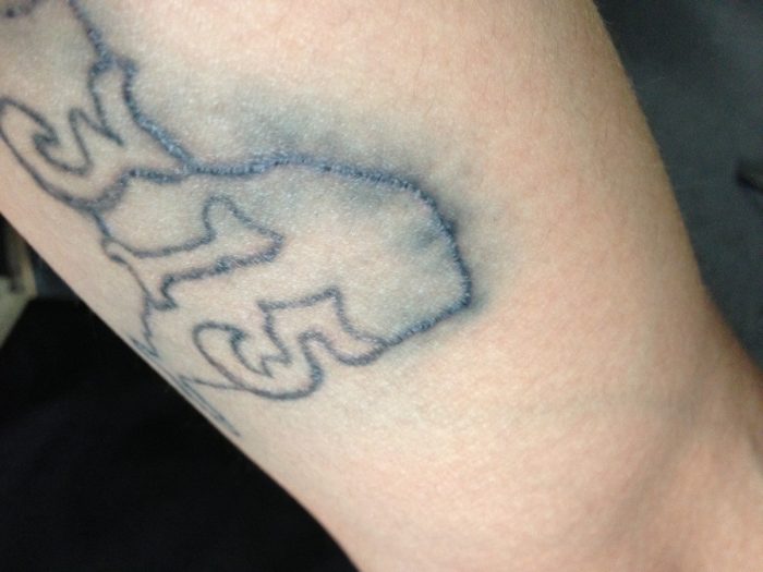 Wat is Tattoo Blowout &Can You Fix It?
